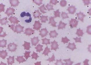 附红细胞体病猪血片的姬姆萨染色