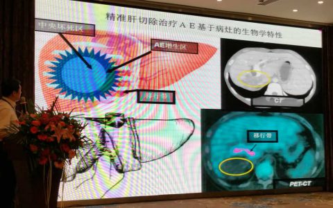 李海涛在2017年全国包虫病防控技术研讨会上作报告